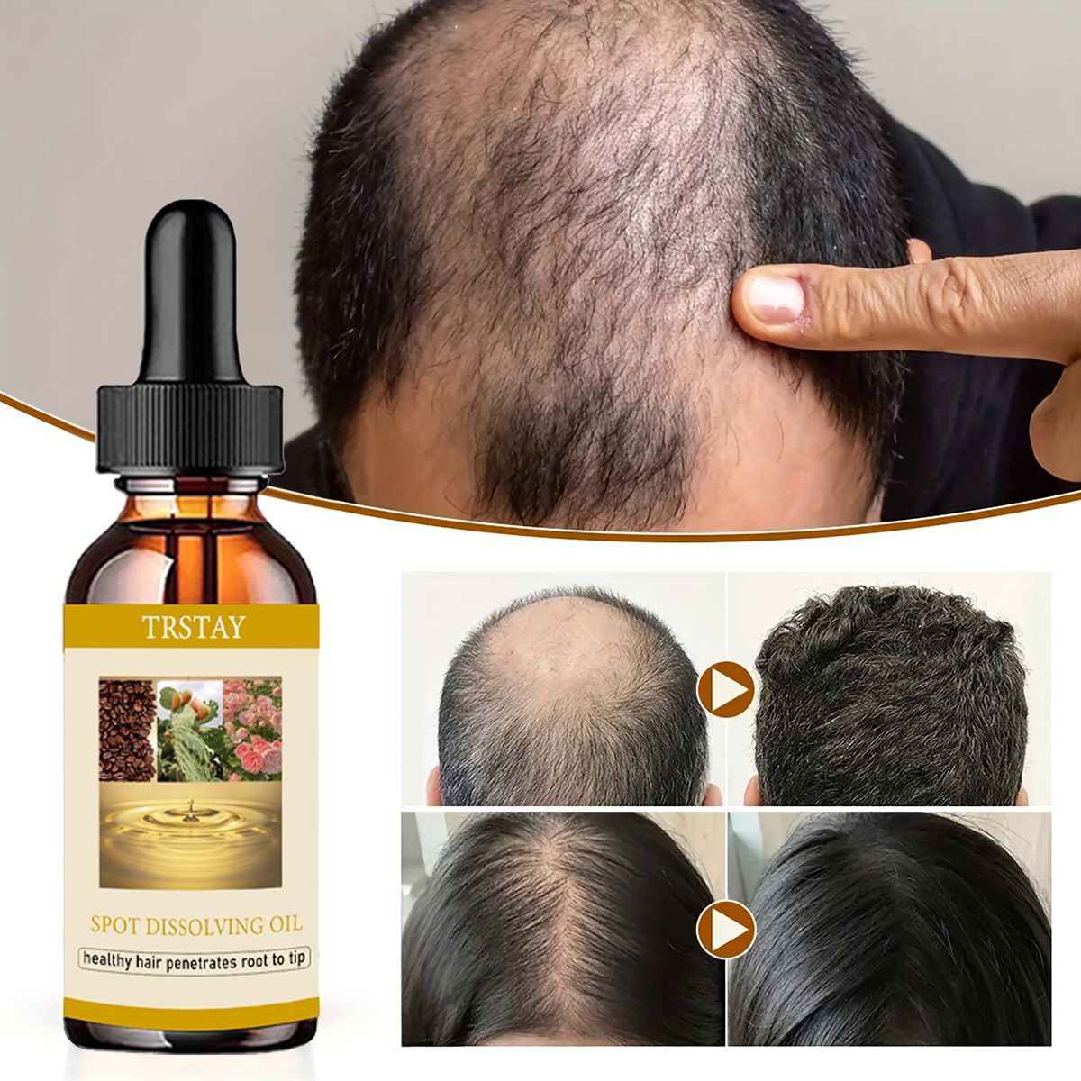 Beard Oil Growth - 50ML sakal uzatma yağ Anti alopesi
