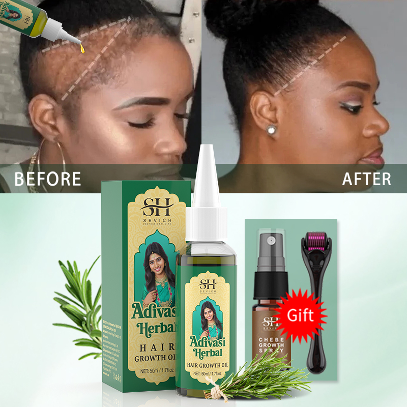 Ayurveda Saç Uzatma Yağı Hindi - Beard Oil Growth incelemesi ve fiyatı