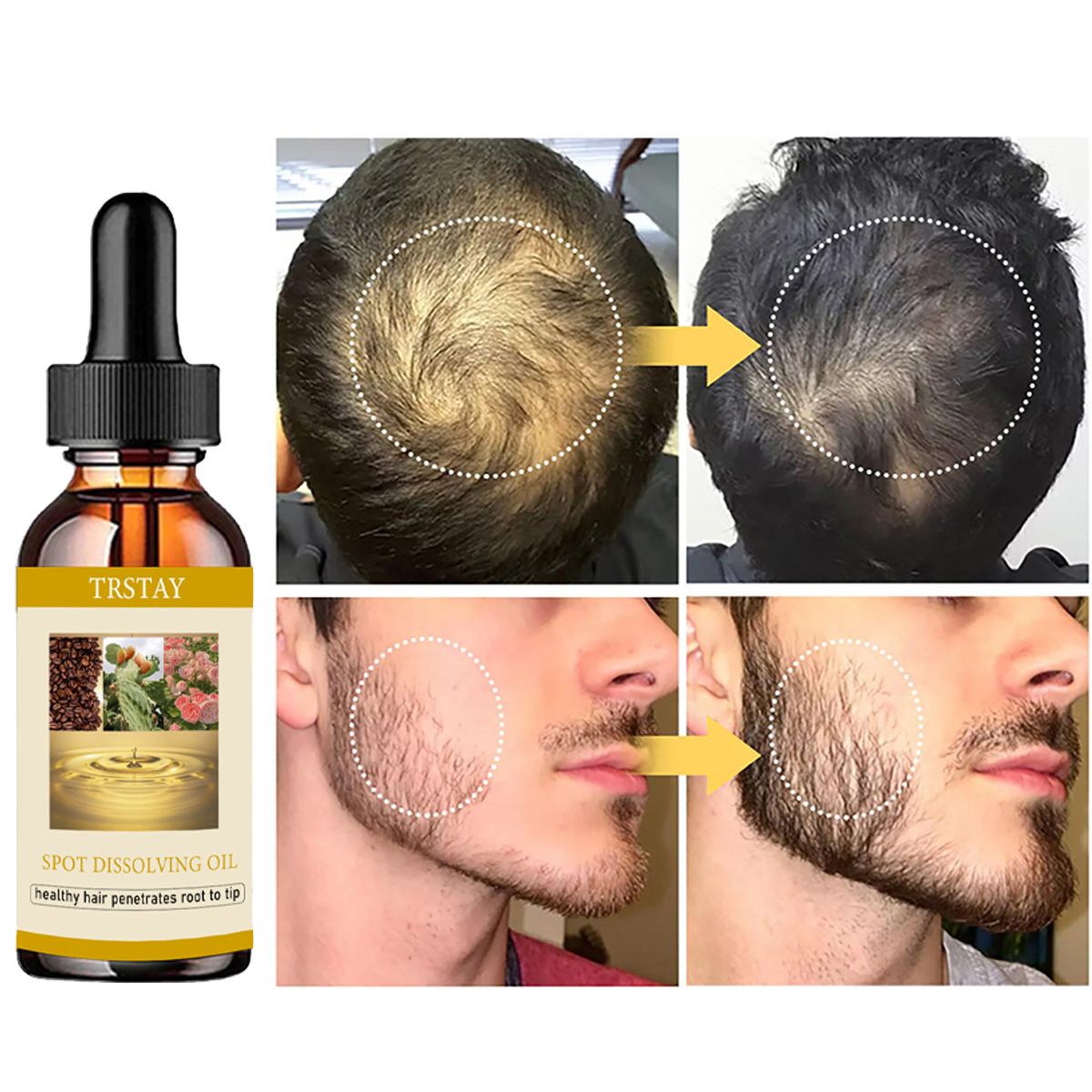 50ML sakal uzatma yağ Anti alo - Beard Oil Growth incelemesi ve fiyatı