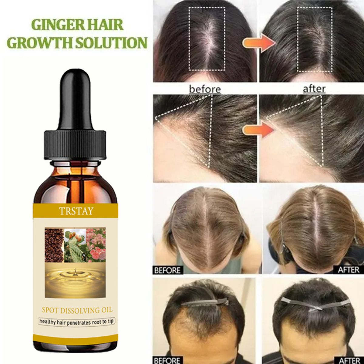50ML sakal uzatma yağ Anti alo - Beard Oil Growth incelemesi ve fiyatı
